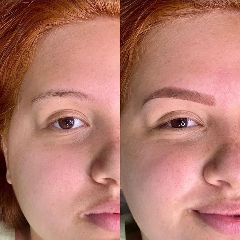Rosto de cliente em comparação lado a lado, antes e depois do procedimento de sobrancelhas.