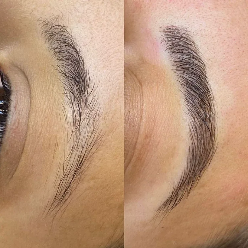 Comparação lado a lado da sobrancelha antes e depois do nanoblading, com fios finos preenchendo as falhas.
